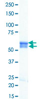 Loading 1 &mu;g protein in SDS-PAGE